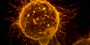 "Η πρώτη φορά που εξαφανίζεται ένας τύπος καρκίνο": Ανακοίνωση - επανάσταση από επιστήμονες