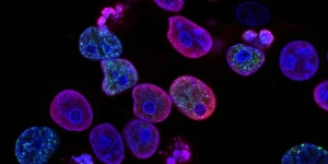 Παγκόσμια Ημέρα κατά του Καρκίνου: 14 συστάσεις για την πρόληψη του καρκίνου από πρύτανη του ΕΚΠΑ